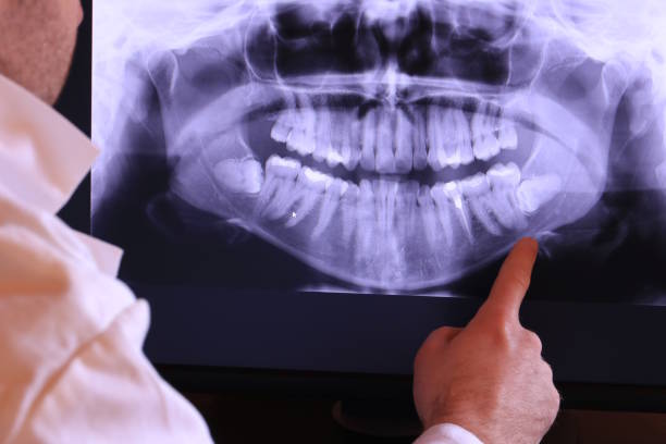 Best Emergency Dental Care for Abscessed Tooth in Kahaluu Keauhou, HI